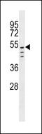 C-Type Lectin Domain Family 18 Member C antibody, 60-216, ProSci, Western Blot image 