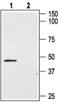 Angiotensin II Receptor Type 2 antibody, PA5-77281, Invitrogen Antibodies, Western Blot image 
