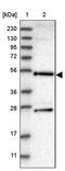 DEAD-Box Helicase 25 antibody, PA5-54159, Invitrogen Antibodies, Western Blot image 