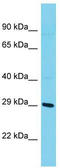 Synaptosomal-associated protein 29 antibody, TA342640, Origene, Western Blot image 