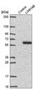 LSM Family Member 14B antibody, HPA061189, Atlas Antibodies, Western Blot image 