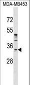 POU domain, class 6, transcription factor 1 antibody, LS-C163881, Lifespan Biosciences, Western Blot image 