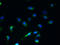 Secretory Carrier Membrane Protein 4 antibody, A60782-100, Epigentek, Immunofluorescence image 