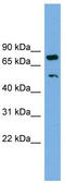 RNA Binding Motif Protein 42 antibody, TA343928, Origene, Western Blot image 