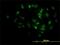 M-Phase Phosphoprotein 10 antibody, H00010199-M02, Novus Biologicals, Immunocytochemistry image 