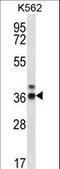 Ribonuclease P/MRP Subunit P38 antibody, LS-C162725, Lifespan Biosciences, Western Blot image 