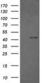 Fc Fragment Of IgG Receptor Ia antibody, NBP2-45625, Novus Biologicals, Western Blot image 
