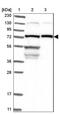 Lanosterol Synthase antibody, NBP1-82474, Novus Biologicals, Western Blot image 
