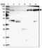 Coronin 7 antibody, NBP1-93946, Novus Biologicals, Western Blot image 