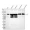 Actinin Alpha 3 (Gene/Pseudogene) antibody, PB10026, Boster Biological Technology, Western Blot image 
