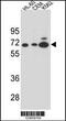 Amylase Alpha 2B (Pancreatic) antibody, 55-348, ProSci, Western Blot image 