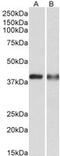 Capping Actin Protein, Gelsolin Like antibody, MBS423299, MyBioSource, Western Blot image 