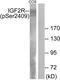Insulin Like Growth Factor 2 Receptor antibody, 79-826, ProSci, Western Blot image 