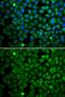 Nuclear pore glycoprotein p62 antibody, GTX32758, GeneTex, Immunocytochemistry image 