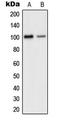 Glutamate Ionotropic Receptor AMPA Type Subunit 2 antibody, LS-C352279, Lifespan Biosciences, Western Blot image 