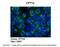 Carnitine Palmitoyltransferase 1A antibody, ARP44796_P050, Aviva Systems Biology, Immunohistochemistry paraffin image 