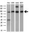 Phosphodiesterase 4A antibody, GTX83922, GeneTex, Western Blot image 