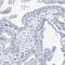 Chromosome 1 Open Reading Frame 87 antibody, HPA031366, Atlas Antibodies, Immunohistochemistry frozen image 