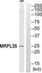 Mitochondrial Ribosomal Protein L35 antibody, PA5-38964, Invitrogen Antibodies, Western Blot image 
