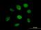 SS18 Subunit Of BAF Chromatin Remodeling Complex antibody, H00006760-B01P, Novus Biologicals, Immunofluorescence image 