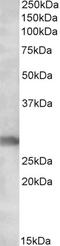 R-Spondin 3 antibody, 42-699, ProSci, Western Blot image 