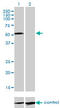Interleukin 13 Receptor Subunit Alpha 2 antibody, LS-C197527, Lifespan Biosciences, Western Blot image 