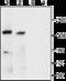Potassium Calcium-Activated Channel Subfamily M Alpha 1 antibody, GTX16725, GeneTex, Western Blot image 
