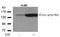 Phospholipase C Gamma 1 antibody, AP02395PU-N, Origene, Western Blot image 