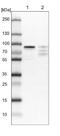Lysine Acetyltransferase 7 antibody, NBP1-92161, Novus Biologicals, Western Blot image 