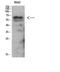 Protein Kinase AMP-Activated Non-Catalytic Subunit Gamma 2 antibody, A02758-2, Boster Biological Technology, Western Blot image 