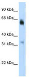 Lysine-specific demethylase 4D antibody, TA345235, Origene, Western Blot image 
