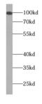 Kizuna Centrosomal Protein antibody, FNab01082, FineTest, Western Blot image 