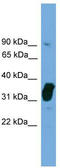 Nitric Oxide Synthase Interacting Protein antibody, TA345091, Origene, Western Blot image 