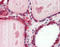 Cathepsin K antibody, TA318059, Origene, Immunohistochemistry paraffin image 