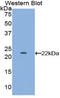 Lipocalin 2 antibody, LS-C300293, Lifespan Biosciences, Western Blot image 