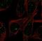 Fatty Acid Desaturase 3 antibody, NBP1-91877, Novus Biologicals, Immunofluorescence image 