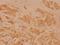 Major Histocompatibility Complex, Class II, DO Alpha antibody, A06776-1, Boster Biological Technology, Immunohistochemistry paraffin image 