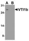 Vesicle Transport Through Interaction With T-SNAREs 1B antibody, LS-B13090, Lifespan Biosciences, Western Blot image 