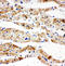 Succinate Dehydrogenase Complex Iron Sulfur Subunit B antibody, LS-C312870, Lifespan Biosciences, Immunohistochemistry frozen image 