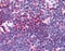 Aurora Kinase A antibody, AP07516PU-N, Origene, Immunohistochemistry paraffin image 