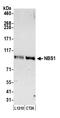 Nibrin antibody, A301-284A, Bethyl Labs, Western Blot image 