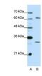 AU RNA Binding Methylglutaconyl-CoA Hydratase antibody, NBP1-57375, Novus Biologicals, Western Blot image 
