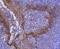 Keratin 2 antibody, NBP2-67838, Novus Biologicals, Immunohistochemistry paraffin image 