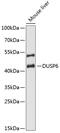 Dual specificity protein phosphatase 6 antibody, GTX32567, GeneTex, Western Blot image 