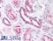MEFV Innate Immuity Regulator, Pyrin antibody, LS-B865, Lifespan Biosciences, Immunohistochemistry paraffin image 
