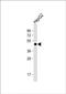 Galactose-1-Phosphate Uridylyltransferase antibody, PA5-72485, Invitrogen Antibodies, Western Blot image 