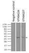 L-lactate dehydrogenase A chain antibody, GTX84226, GeneTex, Immunoprecipitation image 