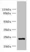 Solute Carrier Family 66 Member 3 antibody, orb356203, Biorbyt, Western Blot image 