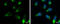 Ribosome Binding Protein 1 antibody, GTX628998, GeneTex, Immunocytochemistry image 