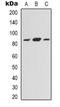 DNA Damage Induced Apoptosis Suppressor antibody, orb339117, Biorbyt, Western Blot image 